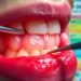 Shocking Insights on Gum Disease - Are Your Gums in Danger? 12 Gum Disease